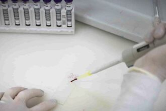 secretaria-de-saude-de-sp-investiga-novo-caso-suspeito-de-ebola